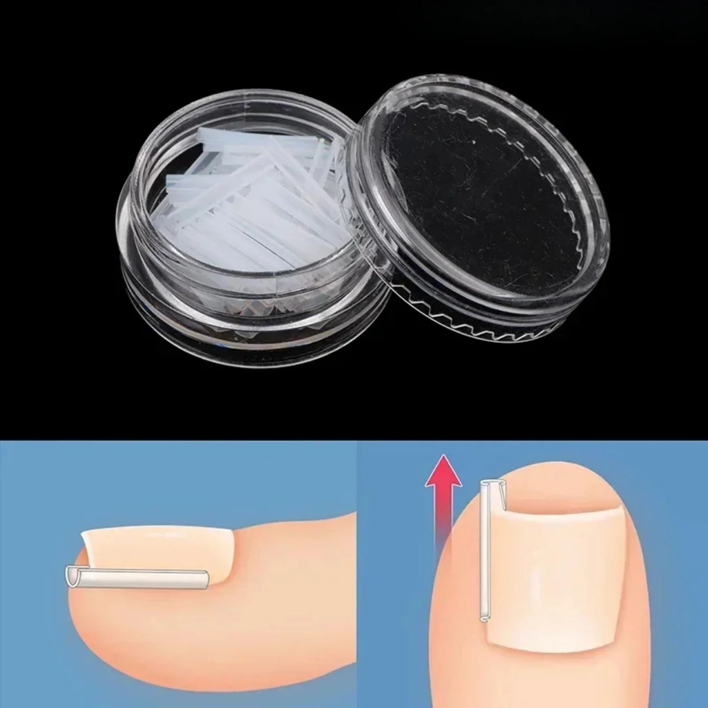 50Pcs Ingrown Toenail Correction Tool Ingrown Toe Nail Treatment Elastic.
