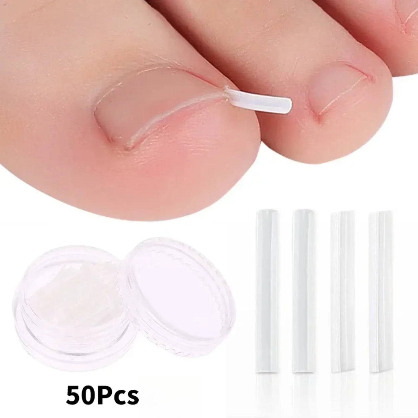 50Pcs Ingrown Toenail Correction Tool Ingrown Toe Nail Treatment Elastic.