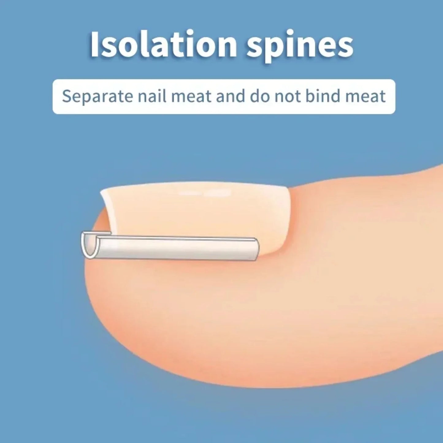 50Pcs Ingrown Toenail Correction Tool Ingrown Toe Nail Treatment Elastic.