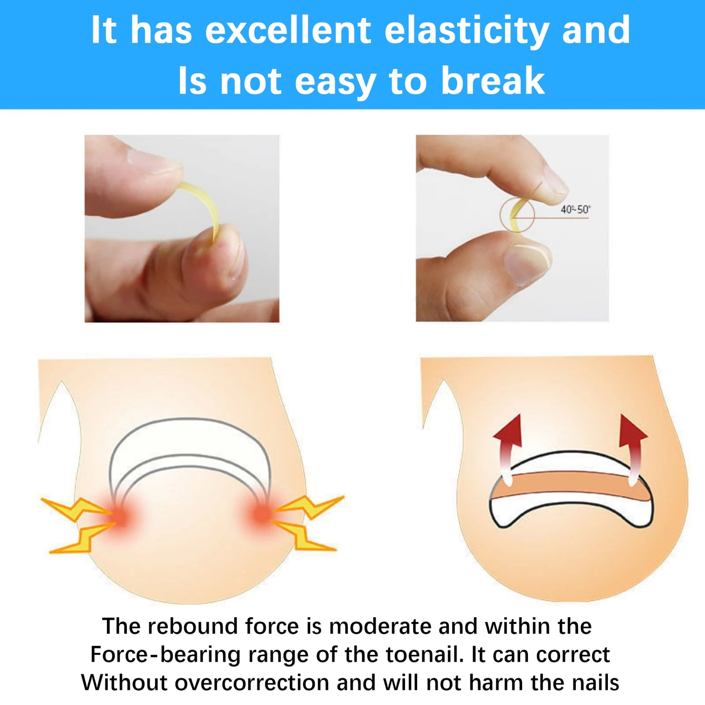 50Pcs Ingrown Toenail Correction Tool Ingrown Toe Nail Treatment Elastic.