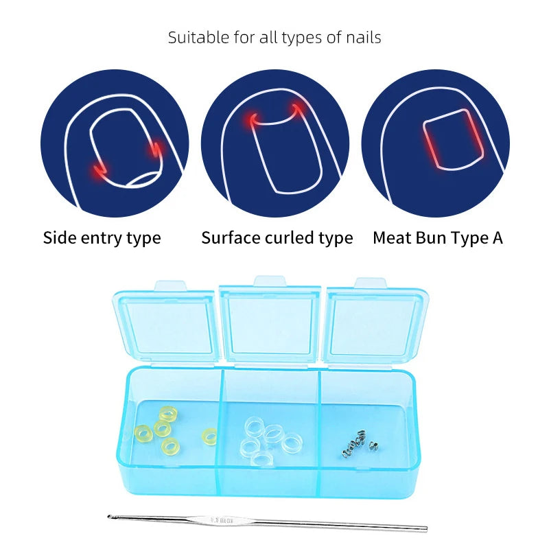 Ingrown Toenail Corrector Pedicure.