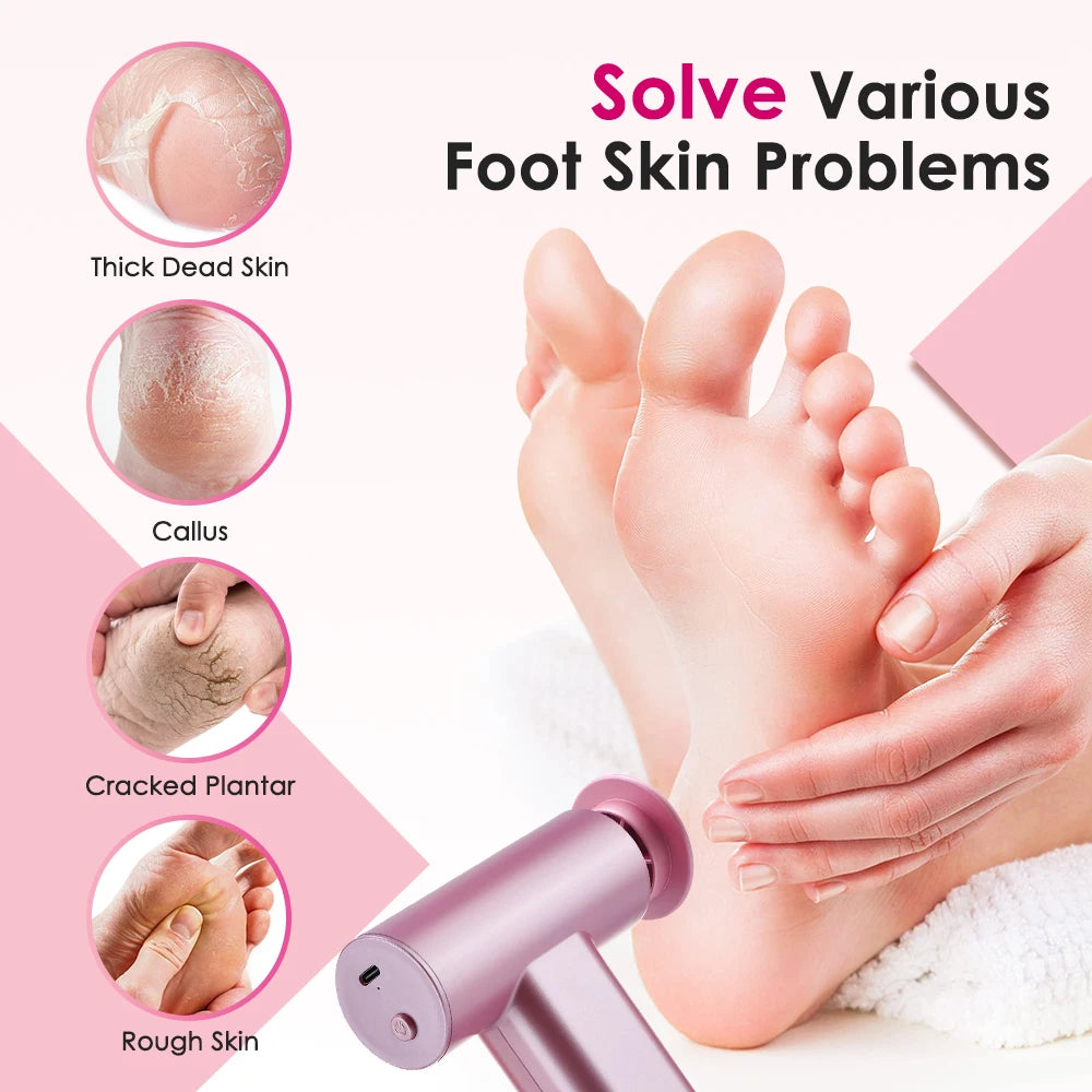 Electric Foot Callus Remover.