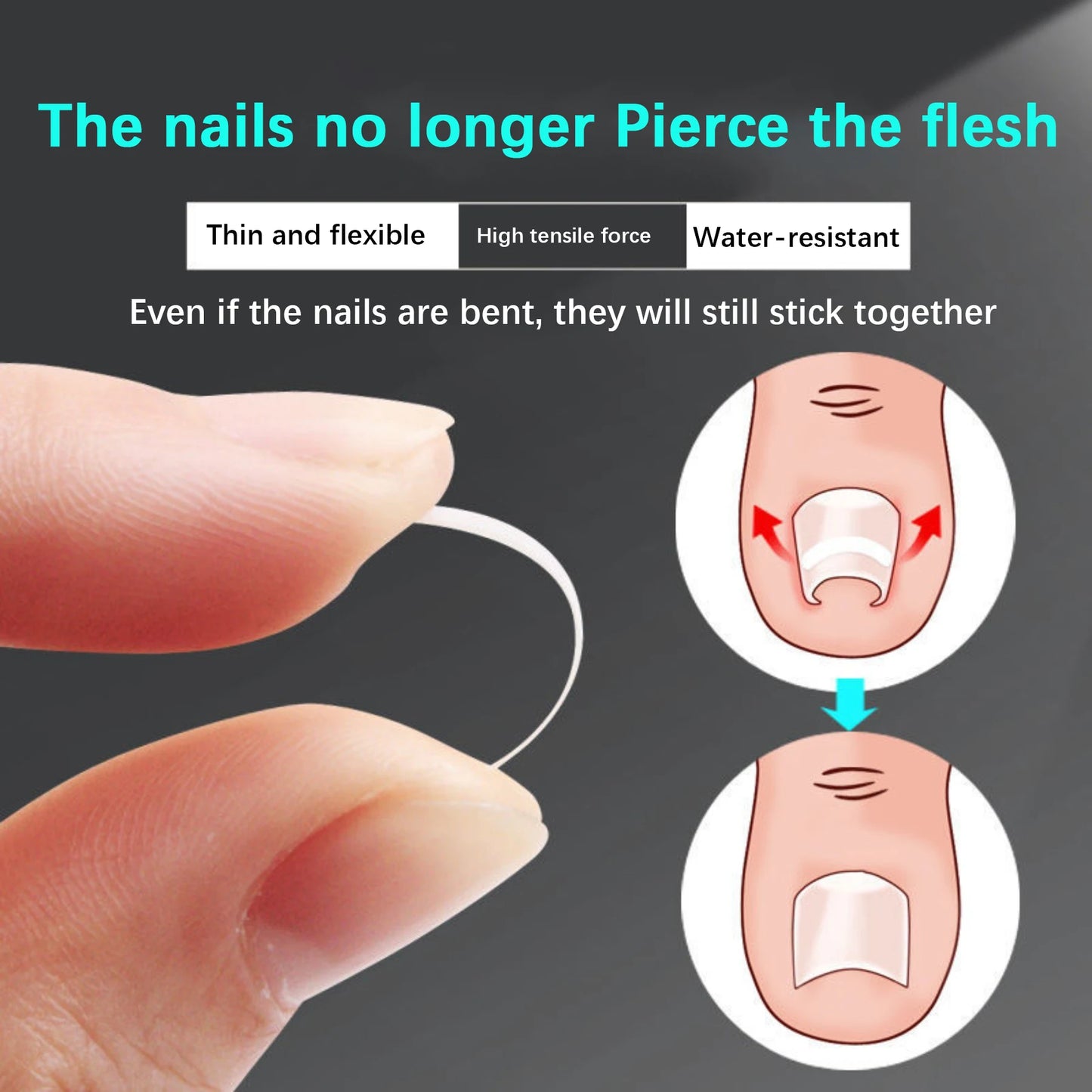 50Pcs Ingrown Toenail Correction Tool Ingrown Toe Nail Treatment Elastic.