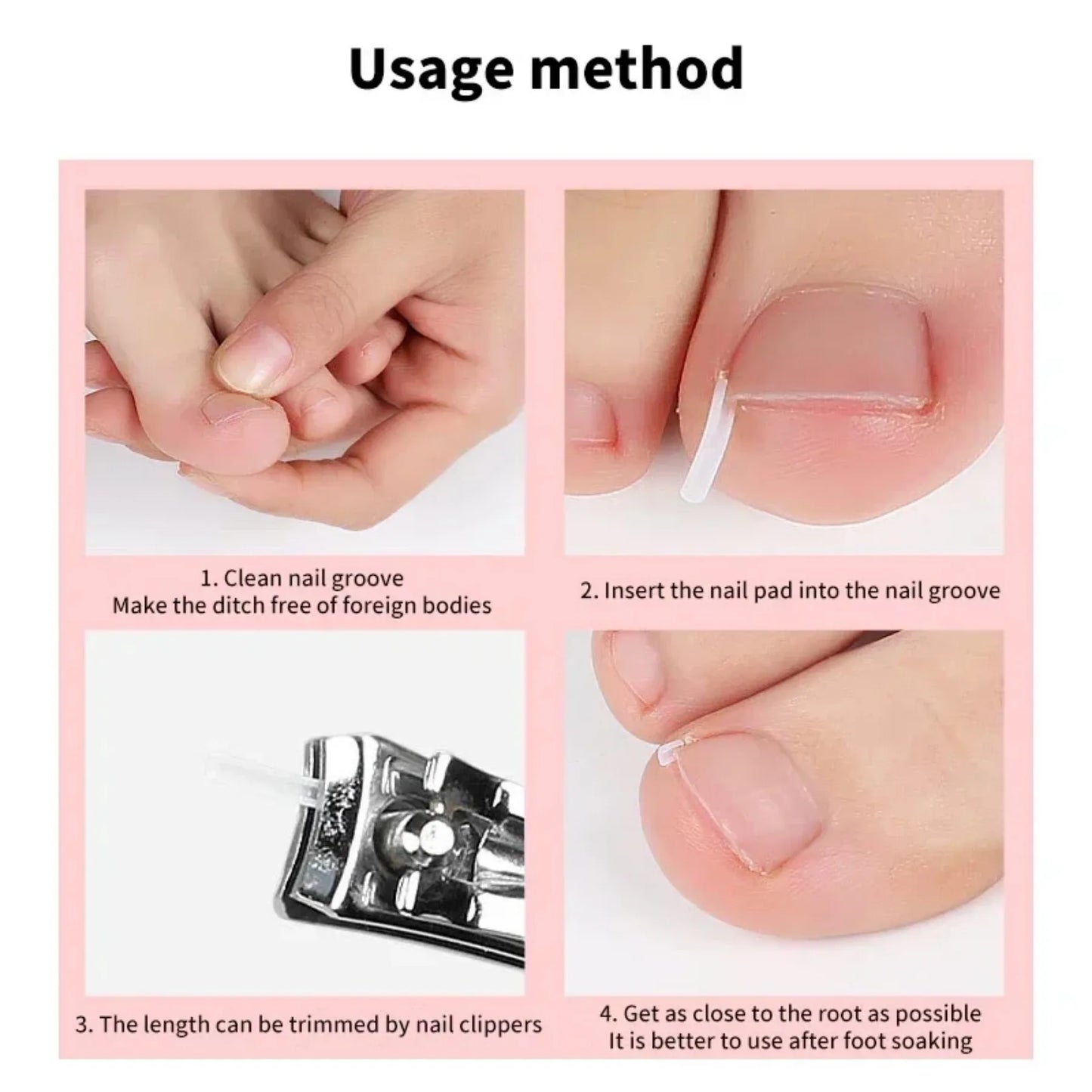 50Pcs Ingrown Toenail Correction Tool Ingrown Toe Nail Treatment Elastic.